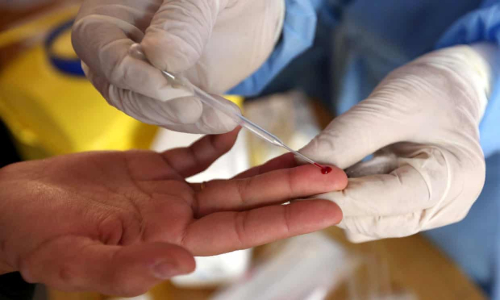 Zhvillohet test gjaku që parashikon se kush do të mbijetojë nga CoVid-19