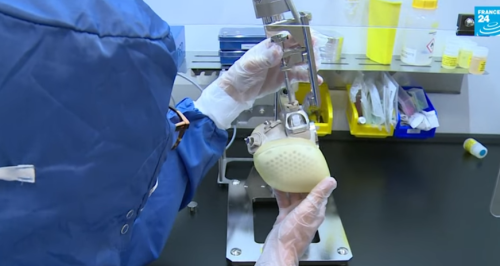 Kompania franceze "Carmat" hedh në treg brenda vitit zemrën e parë artificiale