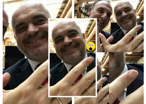 Alo, Edi je? Laj duart dhe pri thonjtë!