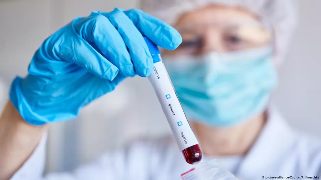 Mbrojtje nga riinfektimi/Imuniteti nga CoVid-19 krijohet që me infektimin e parë dhe zgjat në kohë