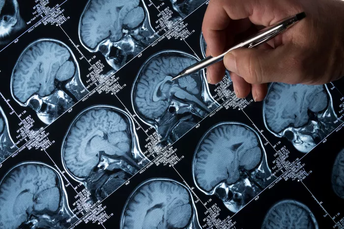 Pasojat e Covid-it/ Nga humbja e kujtesës dhe iktuset, te krizat epileptike