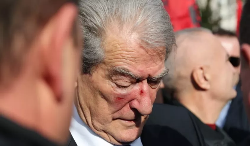 Shteti shqiptar nuk e di se çfarë detyre ka Sali Berisha