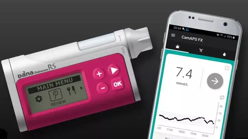Pankreasi artificial revolucionarizon trajtimin e diabetit të tipit 1